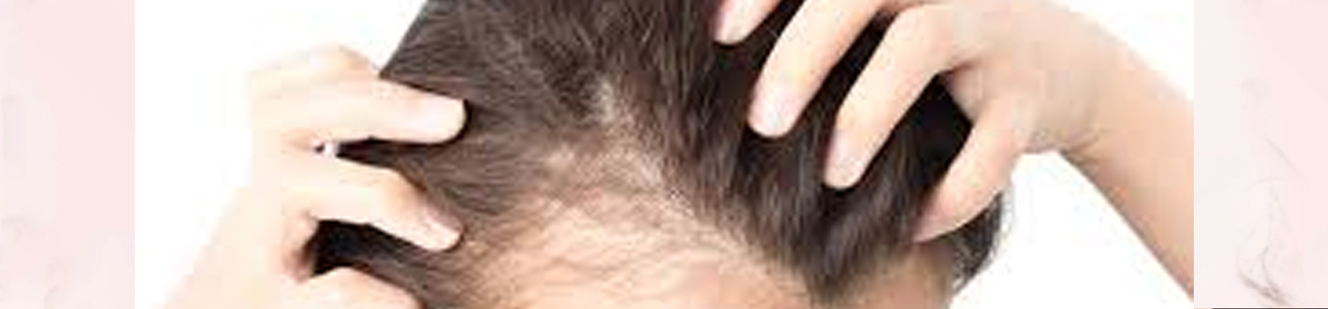 Best Hair Loss Treatment Clinic in Bhubaneswar